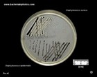 baird parker agar